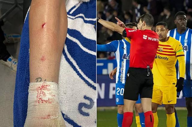 星空体育官网-小老虎被罚下，巴萨佐证自己喷皇马有理？